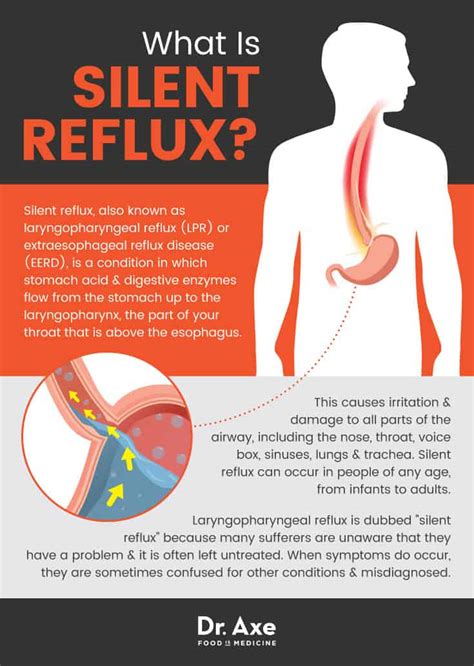 Silent Reflux Symptoms